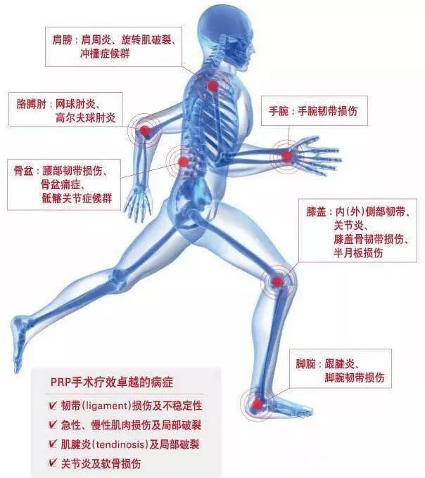 （PRP治疗骨病技术）PRP技术骨病疼痛临床应用培训班